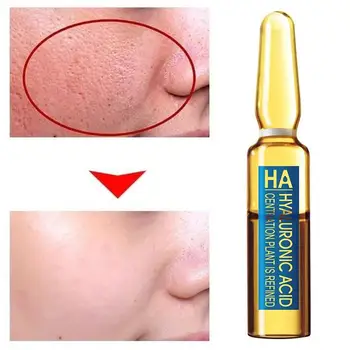 Hialuronskābe ampoule pudeli seruma samazināt poru anti-acne nikotīnamīds balināšanas mitrinošs eļļošana